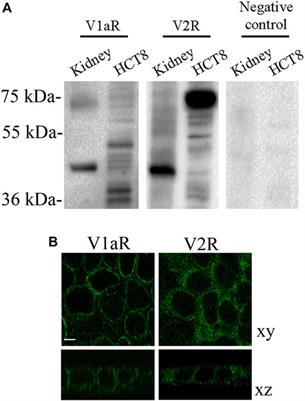 dDAVP Downregulates the AQP3-Mediated Glycerol Transport via V1aR in Human Colon HCT8 Cells